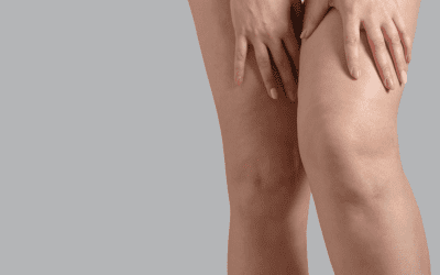 5 Ways Leg Vein Removal Improves Your Quality of Life