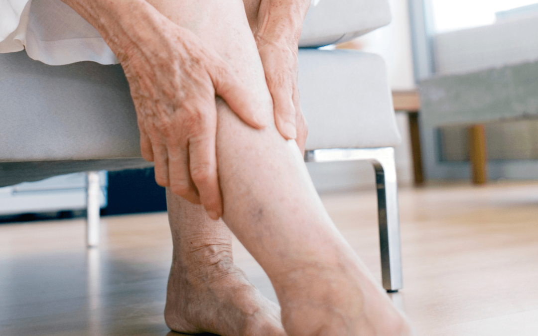 Discover Effective Strategies to Soothe and Strengthen Aching Legs